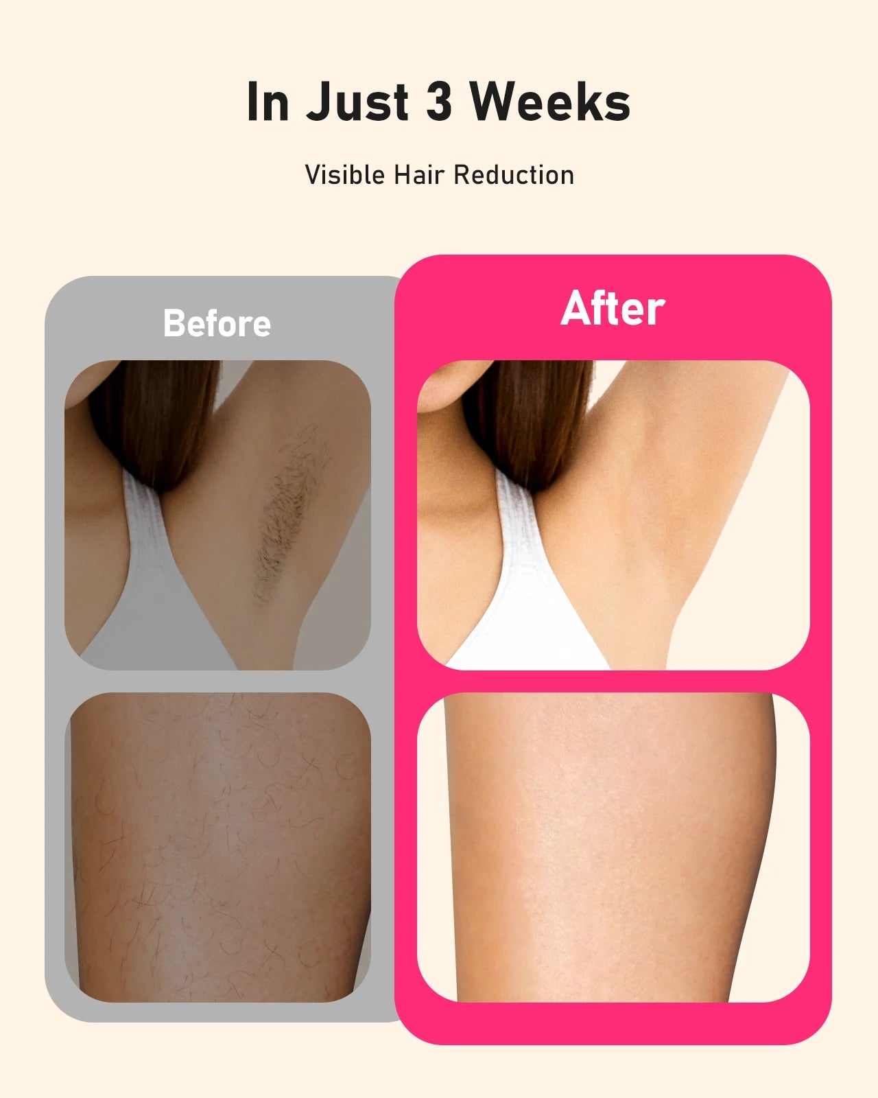 Laser Hair Removal 0.1S/flash 999900+ 22J IPL Hair Remover 3 Modes Body Face Bikini Home Treament Laser Epilator for Women Men