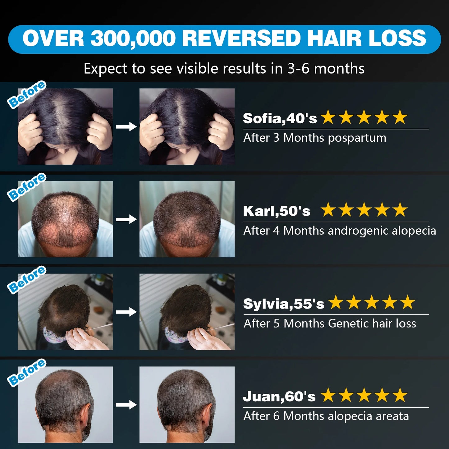 120 Diodes Red Light Therapy Hair Growth Cap 850nm 660nm For Hair Regrowth Anti Hair Loss Scalp Care Hat